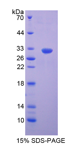 Recombinant S Antigen (SAG)