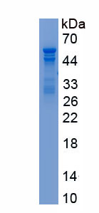 Recombinant Bruton'S Tyrosine Kinase (Btk)