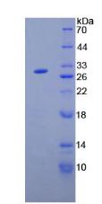 Recombinant Angiopoietin Like Protein 2 (ANGPTL2)