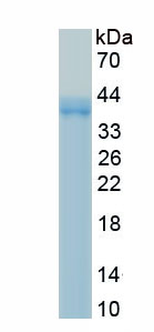 Recombinant Chemokine C-C-Motif Receptor 4 (CCR4)