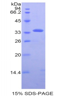 Recombinant Pyruvate Dehydrogenase Beta (PDHb)