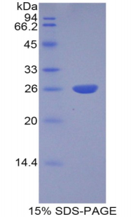 Recombinant Cathepsin S (CTSS)