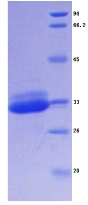 Recombinant Cathepsin S (CTSS)