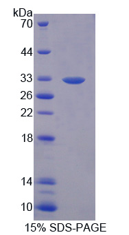 Recombinant Tenascin X (TNX)