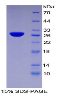 Recombinant Tissue Factor Pathway Inhibitor 2 (TFPI2)