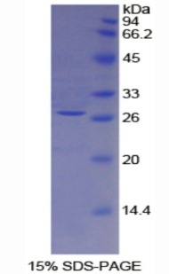 Recombinant Tissue Factor Pathway Inhibitor 2 (TFPI2)