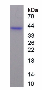 Recombinant Annexin A2 (ANXA2)