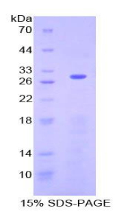 Recombinant Neurofibromin 2 (NF2)