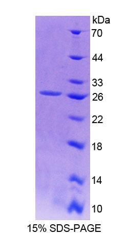 Recombinant Sperm Protein 17 (Sp17)