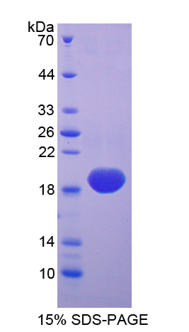 Recombinant Superoxide Dismutase 1 (SOD1)