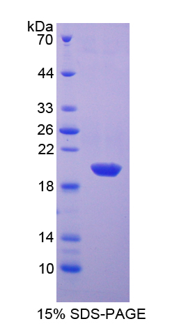 Recombinant Superoxide Dismutase 1 (SOD1)