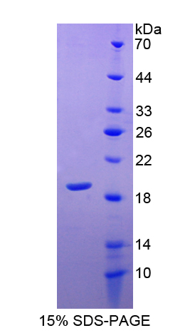 Recombinant Superoxide Dismutase 1 (SOD1)