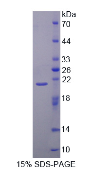 Recombinant Calpain 1 (CAPN1)