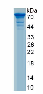 Recombinant Syndecan 1 (SDC1)