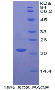 Recombinant Apolipoprotein D (APOD)