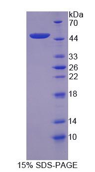 Recombinant Complement Component 8g (C8g)