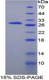 Recombinant Protein S (PROS)