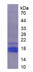 Recombinant Pigment Epithelium Derived Factor (PEDF)