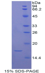 Recombinant A Disintegrin And Metalloproteinase With Thrombospondin 7 (ADAMTS7)