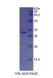 Recombinant Complement Factor I (CFI)