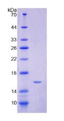 Recombinant Hepcidin (Hepc)