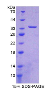 Recombinant Interleukin 33 (IL33)