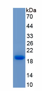 Recombinant Fatty Acid Binding Protein 5 (FABP5)