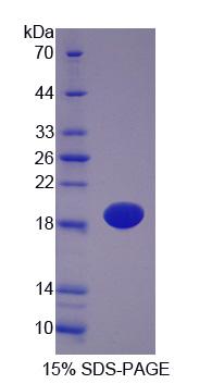 Recombinant Fatty Acid Binding Protein 5 (FABP5)