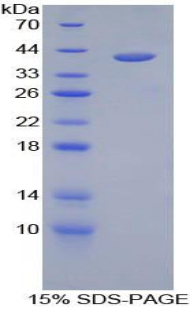 Recombinant Hemojuvelin (HJV)