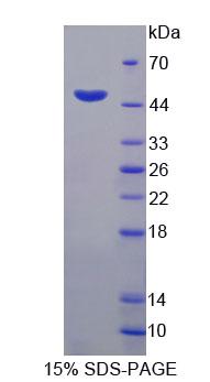 Recombinant Hemojuvelin (HJV)