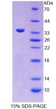 Recombinant Apolipoprotein C2 (APOC2)