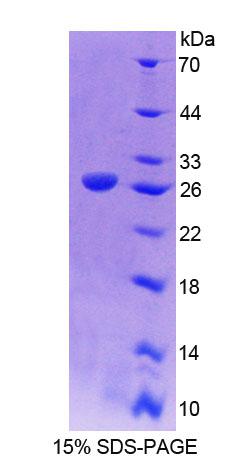 RPC001Hu01.jpg