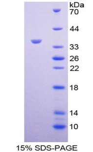 Recombinant Cadherin 17 (CDH17)