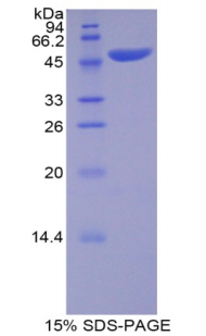 Recombinant Apolipoprotein B (APOB)