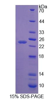 Recombinant Apolipoprotein B (APOB)