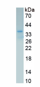 Recombinant Interleukin 8 Receptor Beta (IL8Rb)