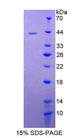 Recombinant S100 Calcium Binding Protein A2 (S100A2)