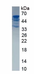 Recombinant Complement Factor B (CFB)