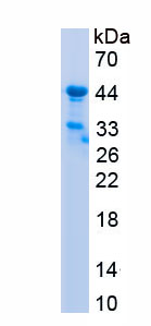 Recombinant Complement Factor B (CFB)