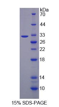 Recombinant Dihydropyrimidine Dehydrogenase (DPYD)