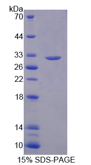 Recombinant Dihydropyrimidine Dehydrogenase (DPYD)