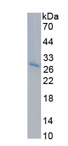 Recombinant Xeroderma Pigmentosum, Complementation Group D (XPD)