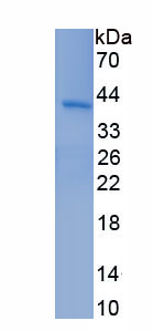 Recombinant Chemokine C-C-Motif Receptor 6 (CCR6)