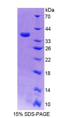 Recombinant Cytochrome P450 17A1 (CYP17A1)