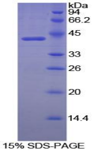 Recombinant Creatine Kinase B (CK-BB)