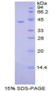 Recombinant Creatine Kinase B (CK-BB)