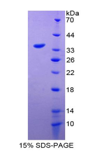 Recombinant Growth Differentiation Factor 15 (GDF15)