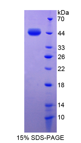 Recombinant S100 Calcium Binding Protein A7 (S100A7)