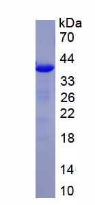 Recombinant Transferrin (TF)