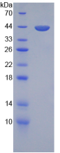 Recombinant Transferrin (TF)